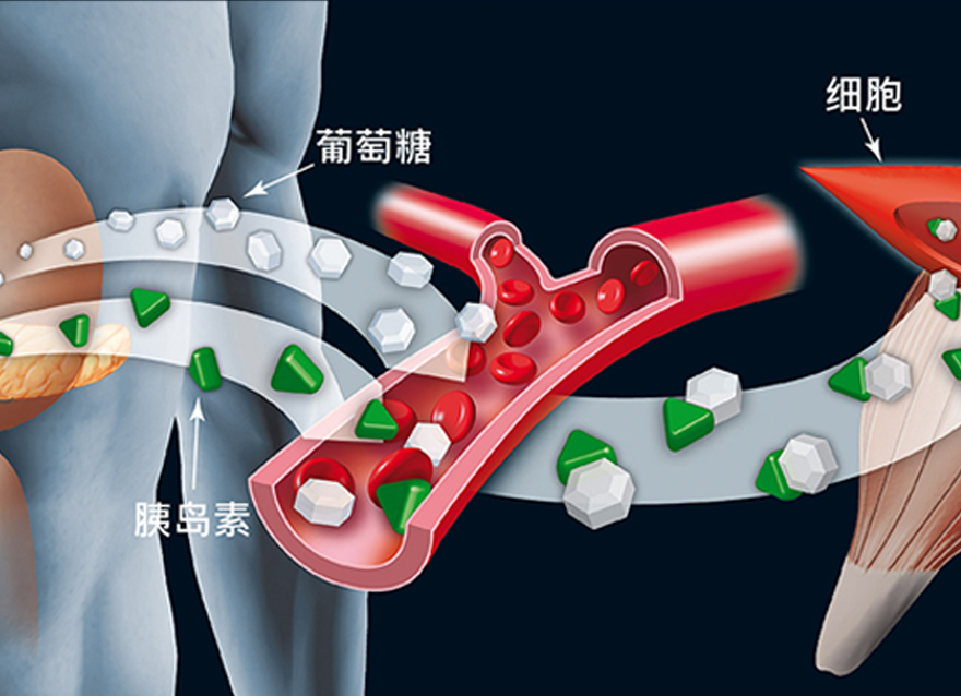 瑞特教你認識糖尿病